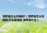 湿疹是什么引起的?（湿疹是怎么引起的,什么是湿疹,湿疹是什么）