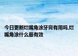 今日更新烂嘴角涂牙膏有用吗,烂嘴角涂什么最有效