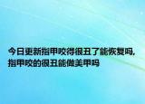 今日更新指甲咬得很丑了能恢复吗,指甲咬的很丑能做美甲吗