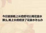 今日更新脸上长痘痘可以用花露水擦么,脸上长痘痘涂了花露水怎么办