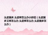 头皮屑多,头皮痒怎么办小妙招（头皮屑多又痒怎么办,头皮痒怎么办,头皮屑多怎么办）