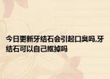 今日更新牙结石会引起口臭吗,牙结石可以自己抠掉吗