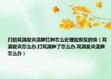打的耳洞发炎流脓红肿怎么处理能恢复的快（耳洞发炎怎么办,打耳洞肿了怎么办,耳洞发炎流脓怎么办）