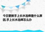 今日更新手上长水泡痒是什么原因,手上长水泡痒怎么办