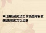 今日更新脸红烫怎么快速消除,敏感肌肤脸红怎么缓解