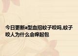 今日更新a型血招蚊子咬吗,蚊子咬人为什么会痒起包