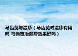 马齿苋与湿疹（马齿苋对湿疹有用吗 马齿苋治湿疹效果好吗）