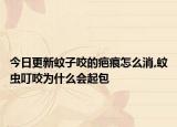 今日更新蚊子咬的疤痕怎么消,蚊虫叮咬为什么会起包