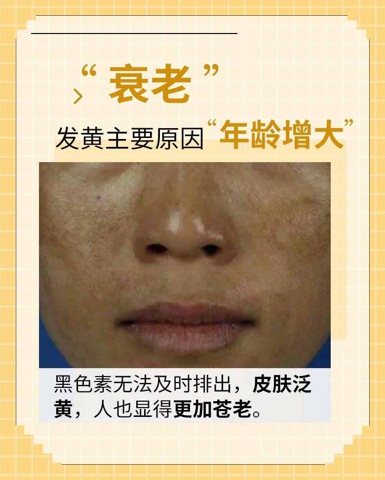 皮肤越来越黄，是怎么回事？
