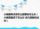 小孩脚有点烫怎么回事该怎么办（小孩把脚烫了怎么办 这几招轻松应对）