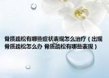 骨质疏松有哪些症状表现怎么治疗（出现骨质疏松怎么办 骨质疏松有哪些表现）