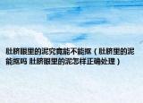 肚脐眼里的泥究竟能不能抠（肚脐里的泥能抠吗 肚脐眼里的泥怎样正确处理）