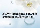 夏天手容易脱皮怎么办（夏天手脱皮怎么回事,夏天手脱皮怎么办）
