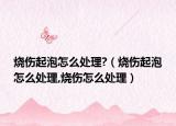 烧伤起泡怎么处理?（烧伤起泡怎么处理,烧伤怎么处理）