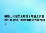 嘴唇上长泡怎么处理（嘴唇上长泡怎么办 教你几招助你快速去除水泡）
