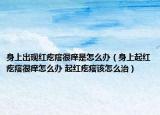 身上出现红疙瘩很痒是怎么办（身上起红疙瘩很痒怎么办 起红疙瘩该怎么治）