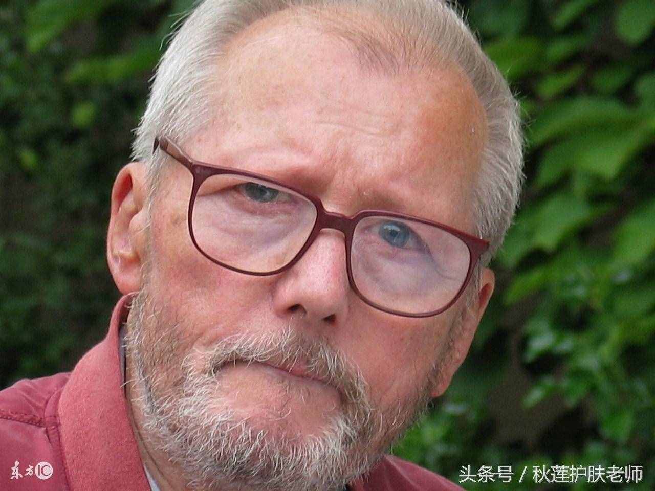 原来红血丝是不会遗传的！那先天红血丝怎么来的？可以治好吗？