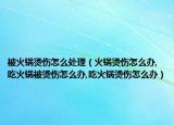 被火锅烫伤怎么处理（火锅烫伤怎么办,吃火锅被烫伤怎么办,吃火锅烫伤怎么办）