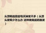 头顶稀疏但是每天掉发不多（头顶头发稀少怎么办 这样做竟能防脱发）