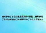 被蚊子咬了怎么快速止痒消肿小妙招（被蚊子叮了怎样快速消除红肿,被蚊子咬了怎么止痒消肿）
