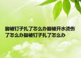 脚被钉子扎了怎么办脚被开水烫伤了怎么办脚被钉子扎了怎么办