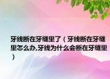 牙线断在牙缝里了（牙线断在牙缝里怎么办,牙线为什么会断在牙缝里）