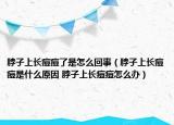 脖子上长痘痘了是怎么回事（脖子上长痘痘是什么原因 脖子上长痘痘怎么办）