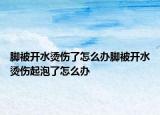 脚被开水烫伤了怎么办脚被开水烫伤起泡了怎么办
