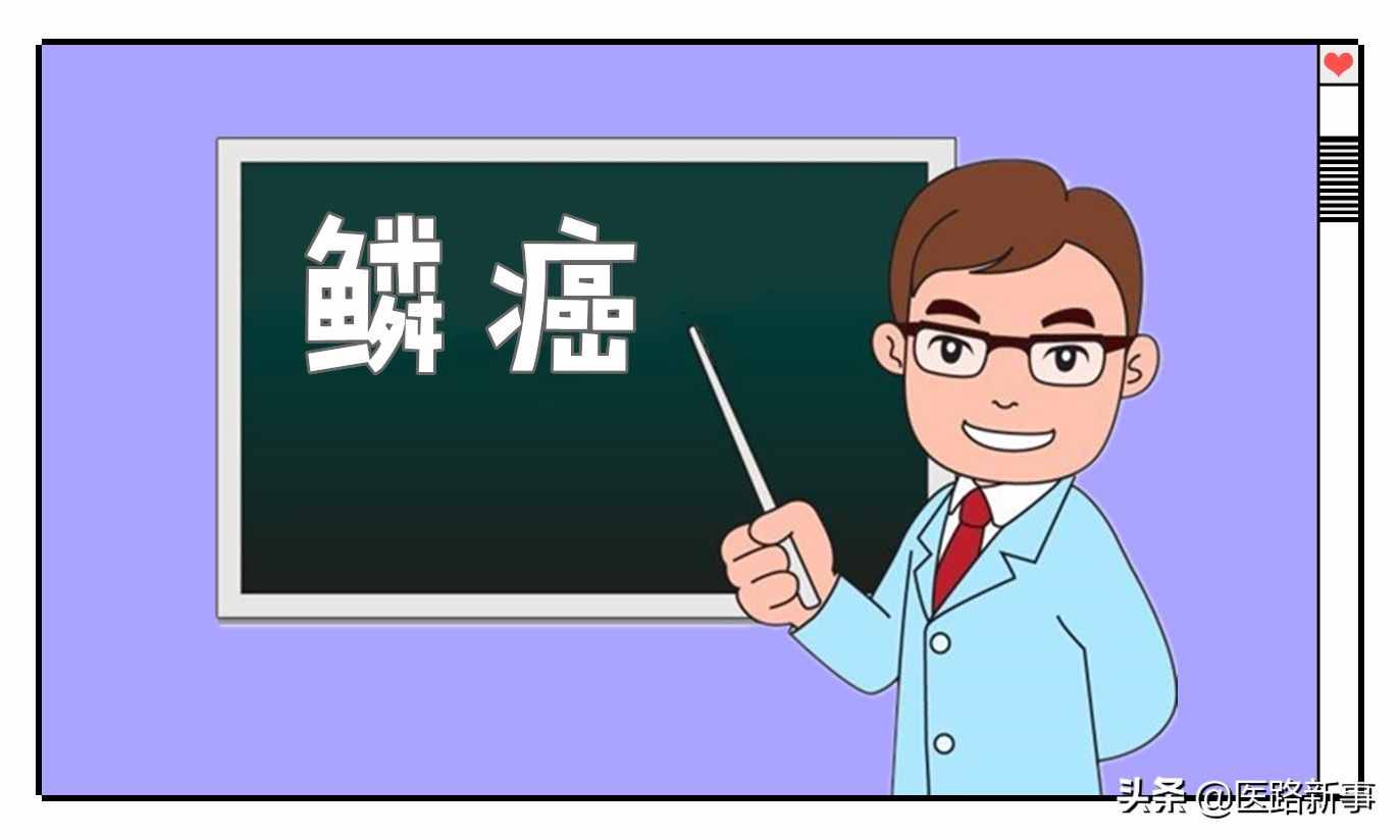 什么是鳞癌？哪些部位容易得呢？日常可以预防吗？赶快来了解