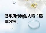 鹅掌风传染他人吗（鹅掌风病）