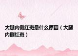 大腿内侧红斑是什么原因（大腿内侧红斑）
