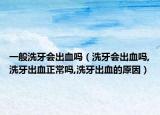 一般洗牙会出血吗（洗牙会出血吗,洗牙出血正常吗,洗牙出血的原因）