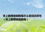 肾上腺嗜铬细胞瘤怎么鉴别良恶性（肾上腺嗜铬细胞瘤）