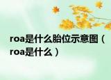 roa是什么胎位示意图（roa是什么）