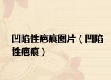 凹陷性疤痕图片（凹陷性疤痕）