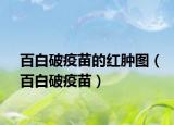 百白破疫苗的红肿图（百白破疫苗）