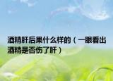 酒精肝后果什么样的（一眼看出酒精是否伤了肝）