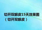 切开双眼皮15天效果图（切开双眼皮）