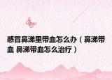 感冒鼻涕里带血怎么办（鼻涕带血 鼻涕带血怎么治疗）