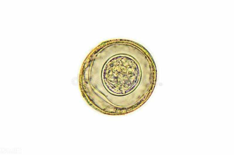 怎么知道肚子里有没有蛔虫？医生：可试试这2种辨别方法