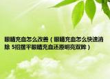 眼睛充血怎么改善（眼睛充血怎么快速消除 5招摆平眼睛充血还原明亮双眸）