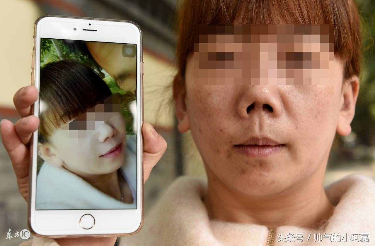 看完假体隆鼻的这3个危害 你再好好考虑