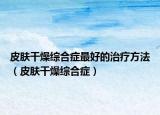 皮肤干燥综合症最好的治疗方法（皮肤干燥综合症）