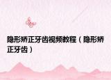 隐形矫正牙齿视频教程（隐形矫正牙齿）
