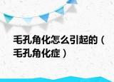 毛孔角化怎么引起的（毛孔角化症）