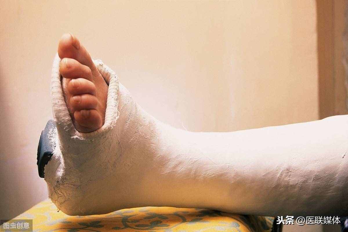 骨折后吃什么好得快？告诉你3种补钙的食物，别只盯着骨头汤