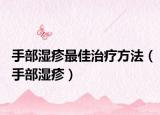 手部湿疹最佳治疗方法（手部湿疹）