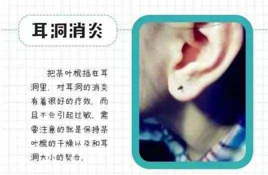 30个茶叶的妙用清单，值得收藏