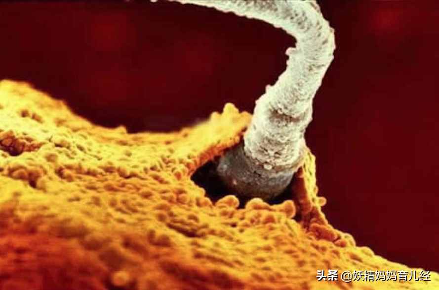 宝宝在妈妈肚子里是什么样？20张胎儿发育高清图，满足孕妈好奇心