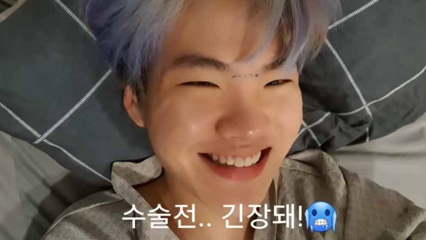 韩国男星晒整容前后对比，差距太大很惊人，被指最新照鼻尖像有坑